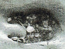 Les pêcheries préhistoriques de Saint Jean le Thomas Les pêcheries préhistoriques de Saint Jean le Thomas